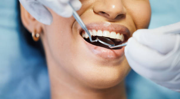 Best Broken or Chipped Tooth Repair in Tome, NM